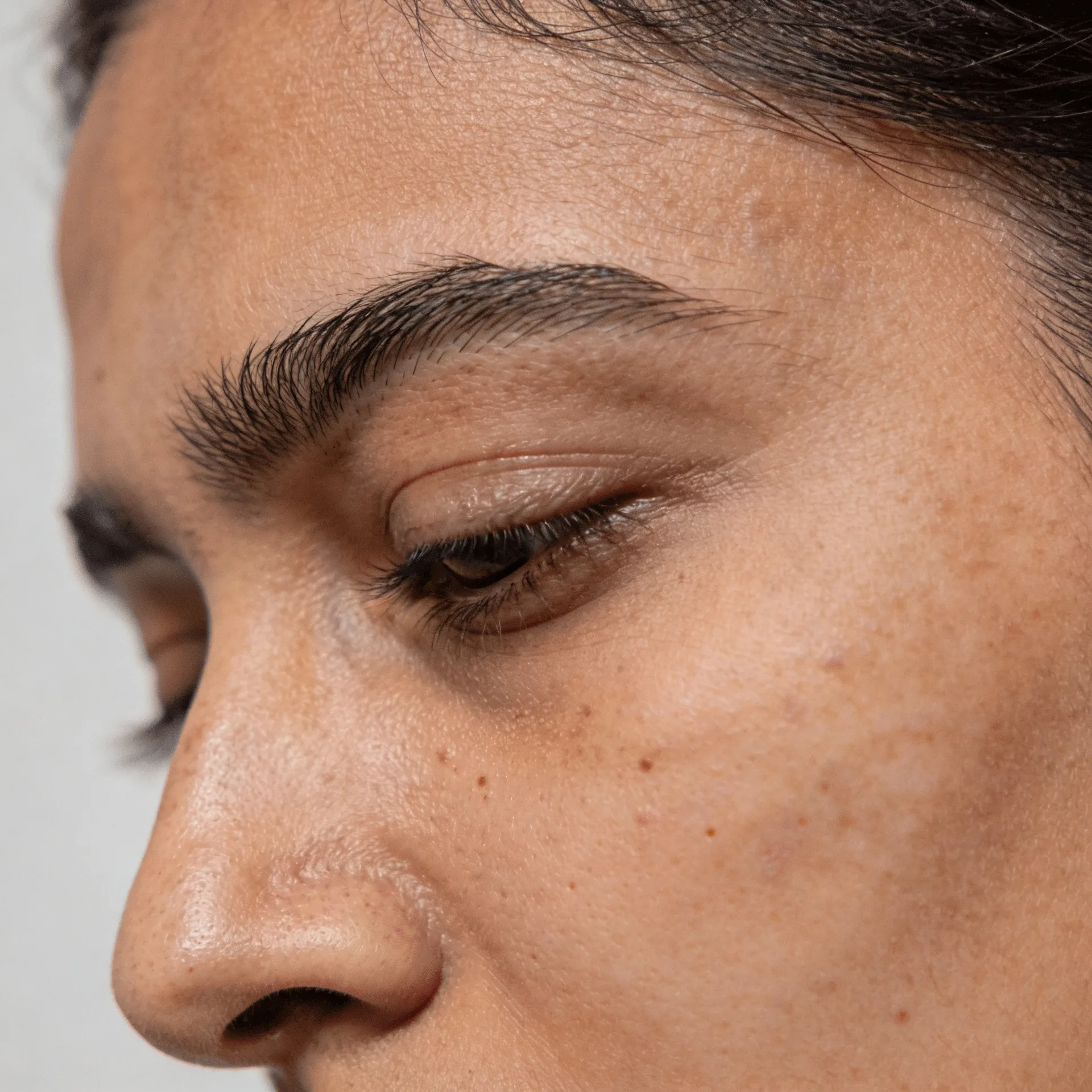 Special area pigmentation and brightening treatment