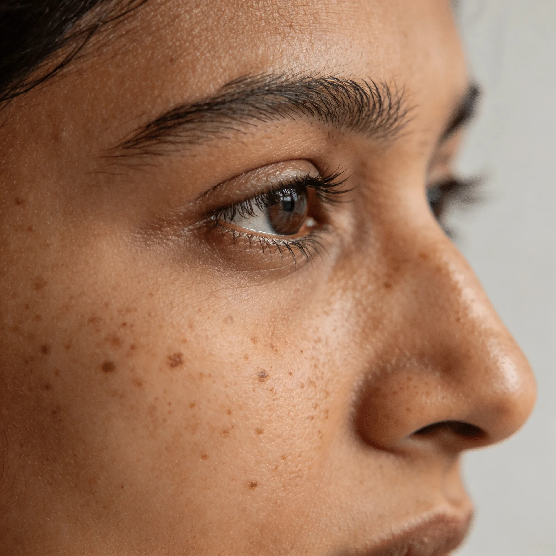 Acne and acne scar treatment