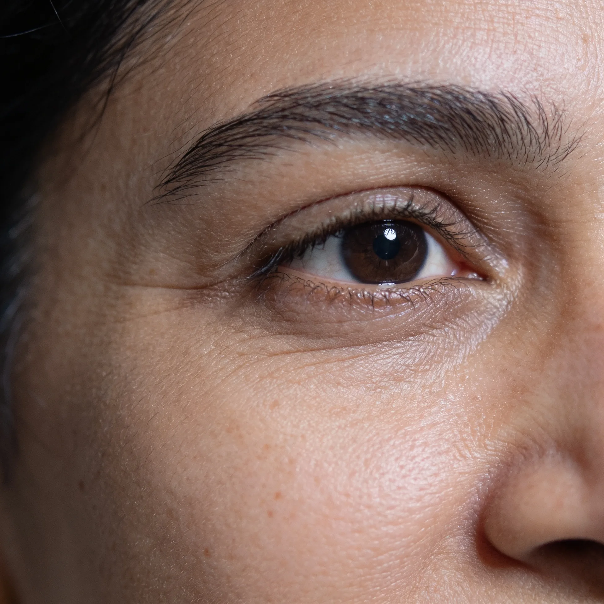 Wrinkles and fine lines treatment