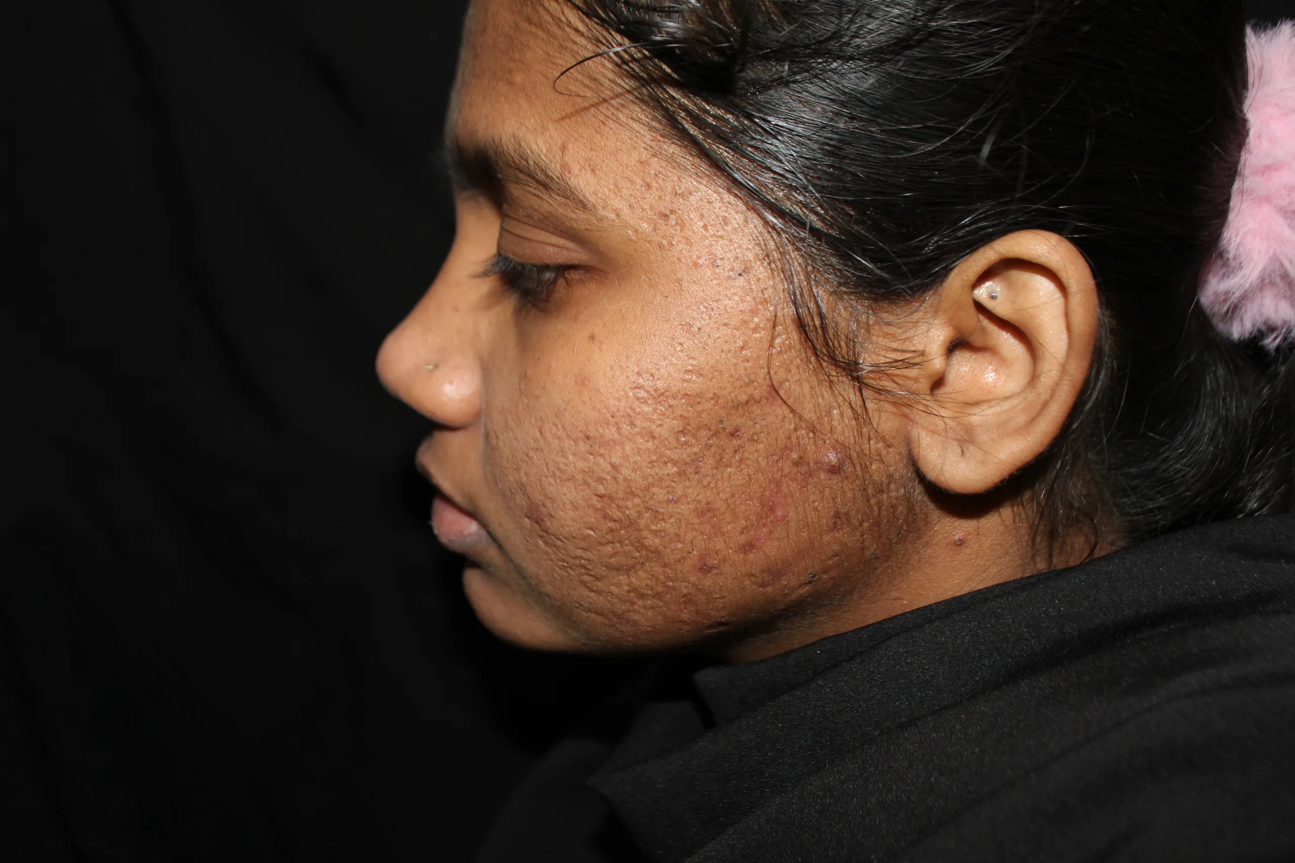 Before skin brightening treatment concern
